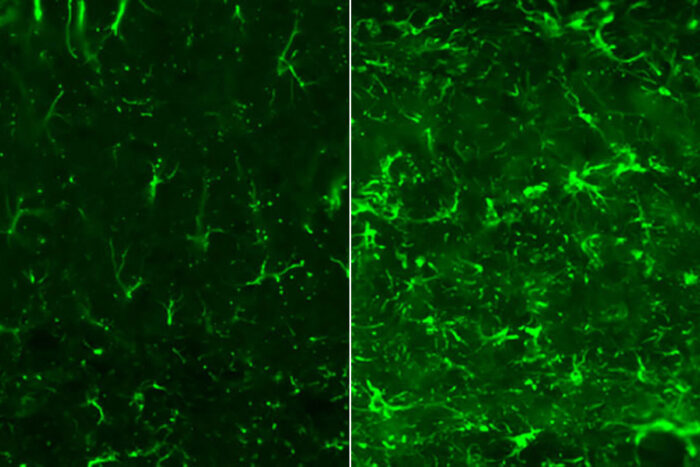 astrocytes in treated left vs untreated right mouse brain