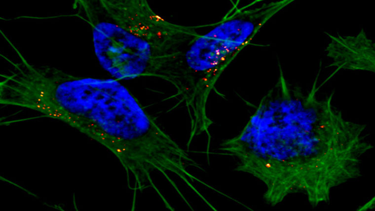 Amiloide-beta: la proteina cambia forma per entrare nei neuroni