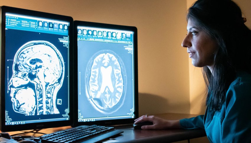 brain imaging with radiology