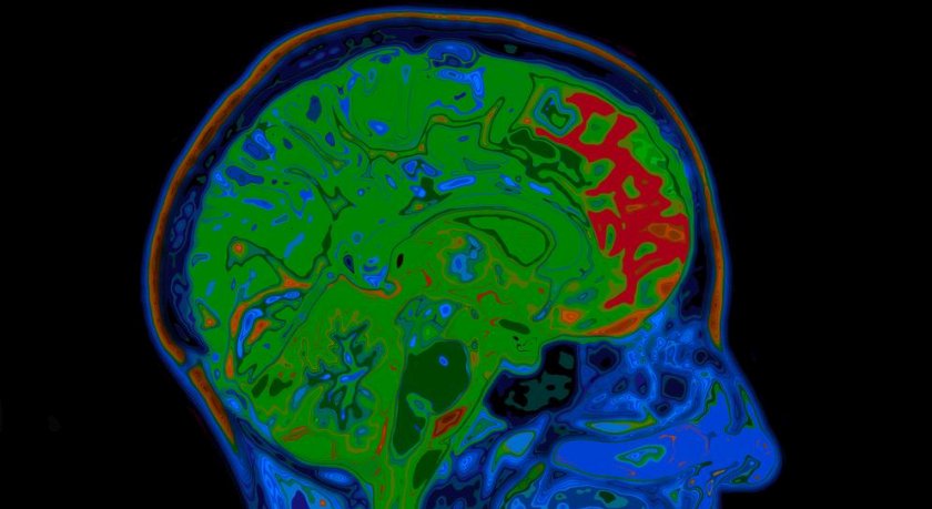 brain scan anatomy iStock 522798525