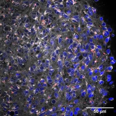 Organoide cerebrale, con la tau in rosso, lipidi in bianco e i nuclei cellulari in blu. (Fonte: Anna Oliveras). brain organoid with tau in red lipids in white and cell nuclei in blue