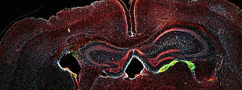 Scienziati trasformano cellule del sangue in neuroni