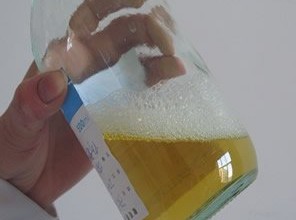 Protenine nelle urine collegate a rischio più alto di demenza