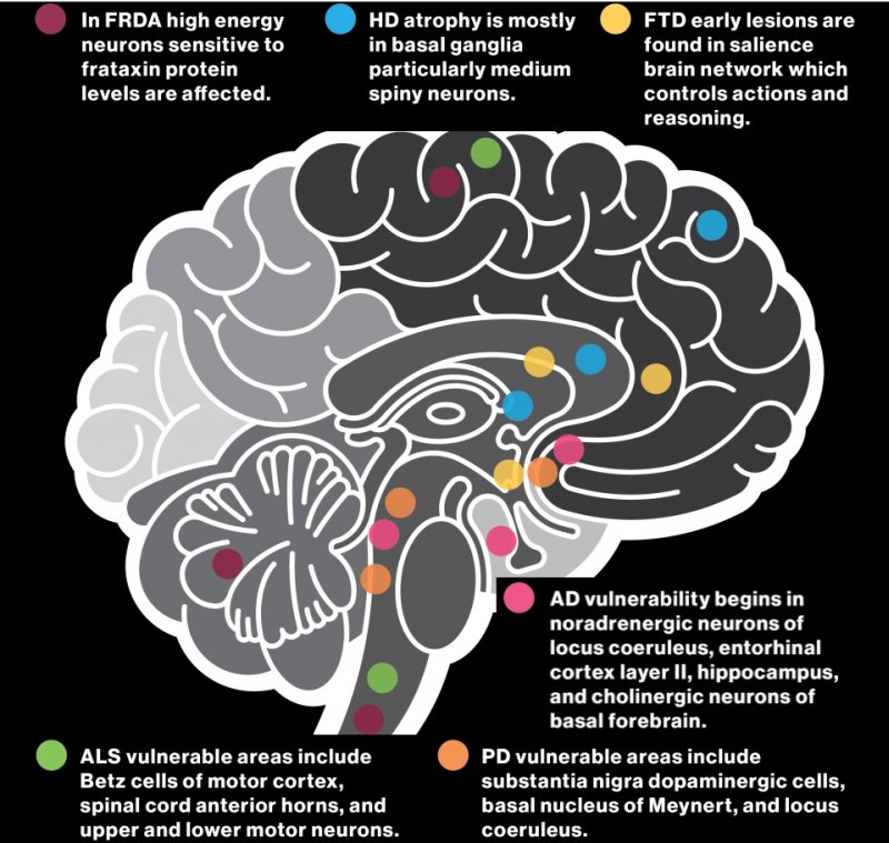 cell types and brain regions affected by six neurodegenerations