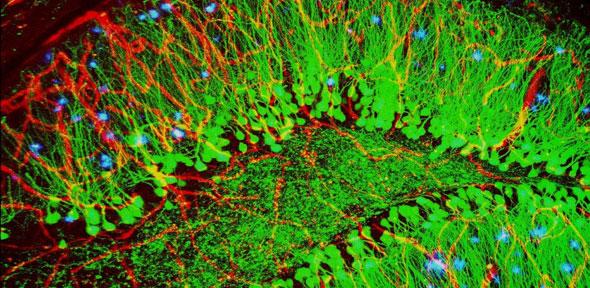Nuova tecnica di scansione misura la tossicità delle proteine dell'Alzheimer e del Parkinson