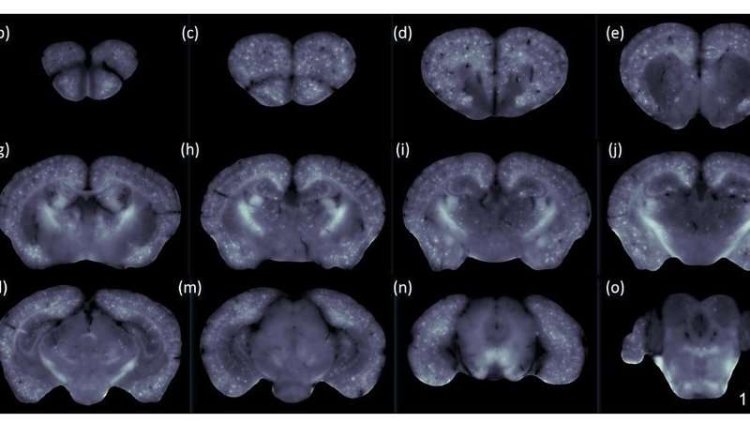 Nuovo tipo di scansione mappa i cambiamenti del MA nell'intero cervello di topi