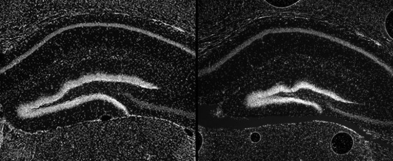 Il DNA della 'materia scura' influenza sviluppo del cervello: conseguenze per l'Alzheimer