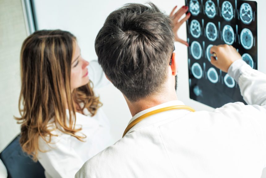 doctors looking at brain scans