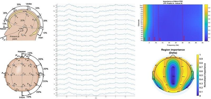 eeg dementia graph