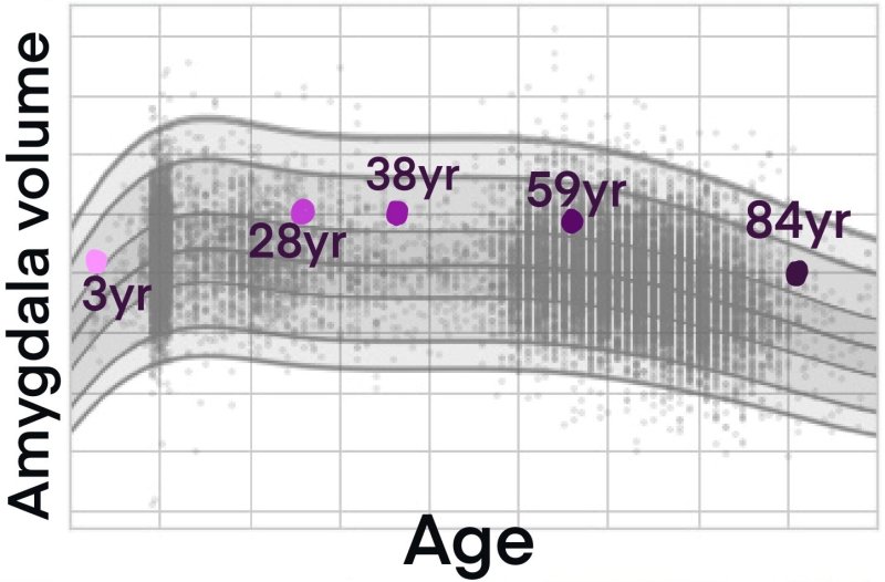 example of brain growth chart