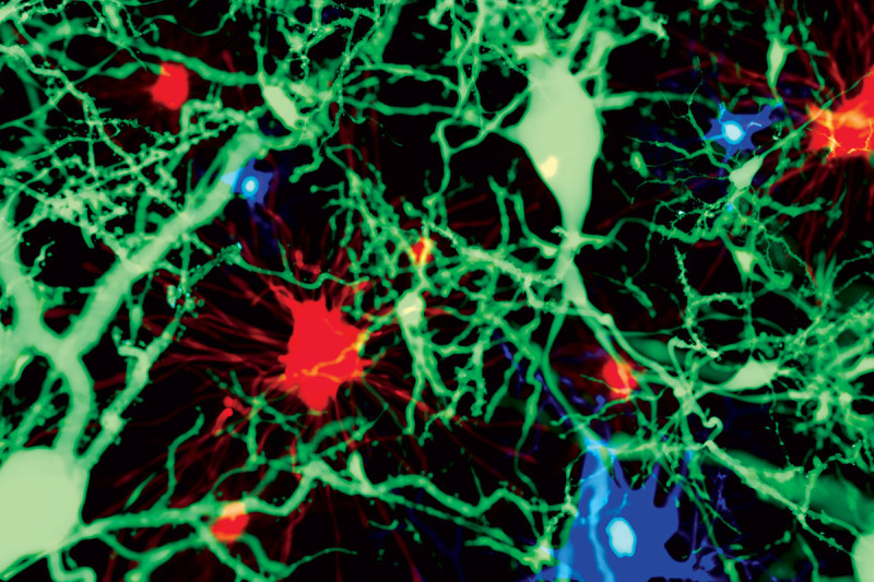 Misteriose cellule cerebrali scure legate all'Alzheimer e allo stress