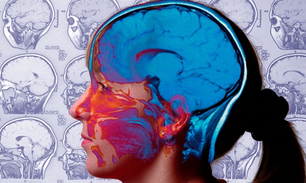 Modulando i circuiti cerebrali dello stress si potrebbe prevenire l'Alzheimer