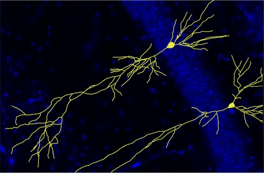 fewer synaptic links in neurons app lacking