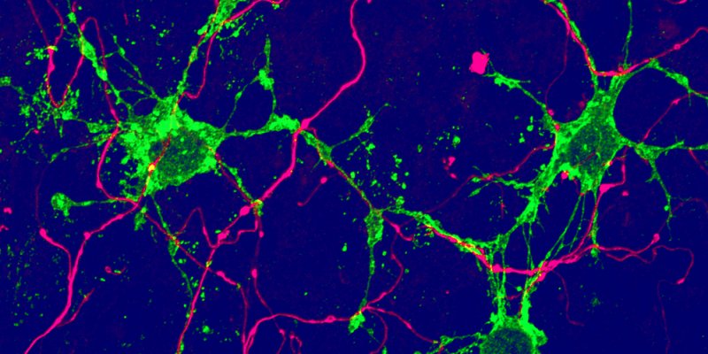 glia cell green arising from adult stem cells in the brain