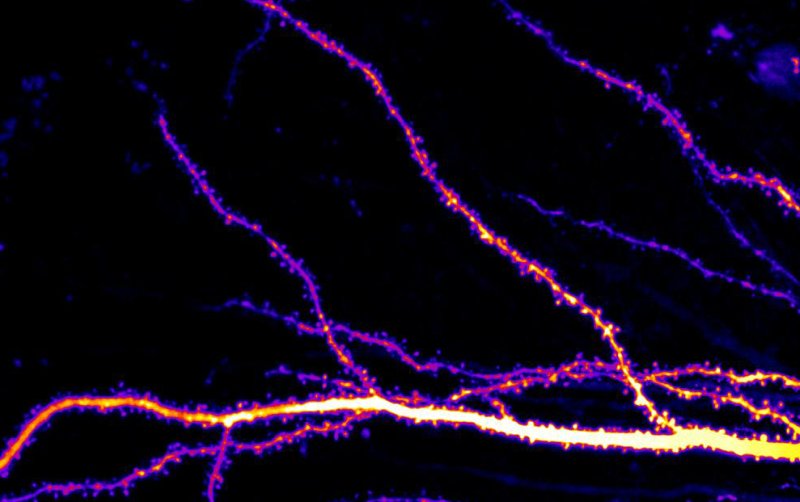 hippocampal neurons in PKCa mice with fewer dendrites
