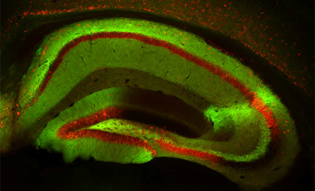 Sottoprodotto del processo di Alzheimer stimola la comunicazione tra neuroni