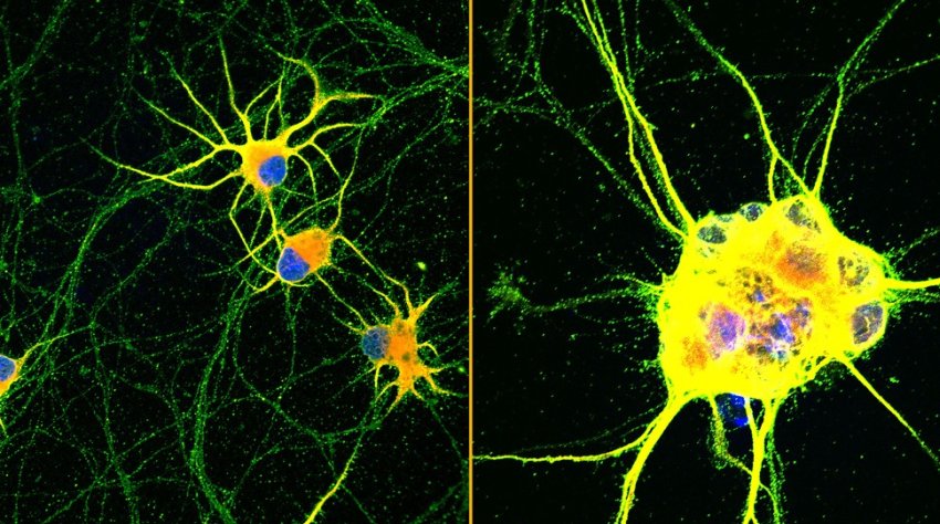 human neurons red green blue growing on coatings