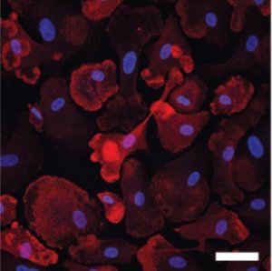 immunofluorescence staining of microglia specific marker IBA 1