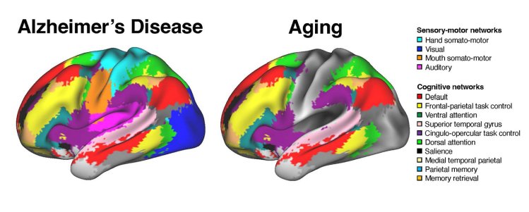 impact of aging and AD on brain functions