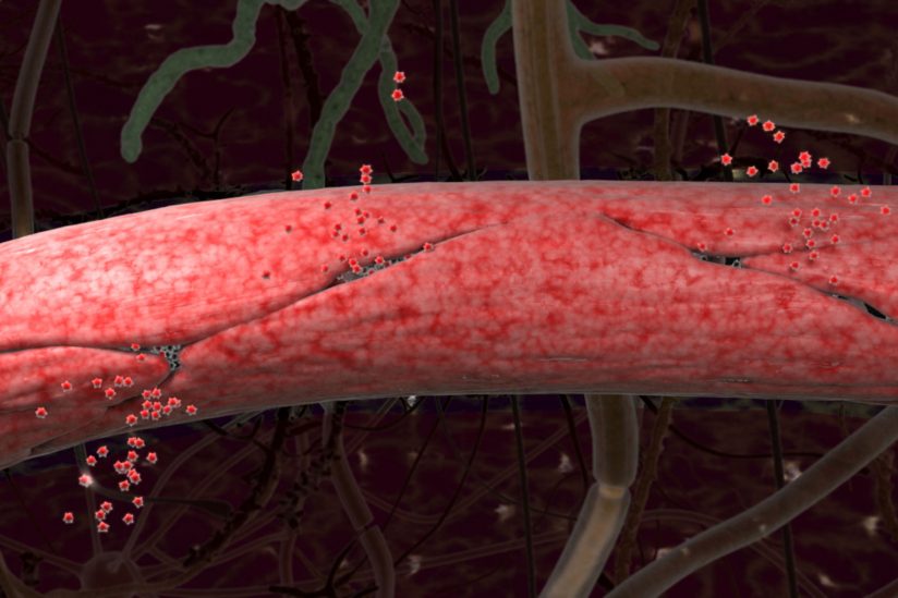 leaky brain blood barrier capillary