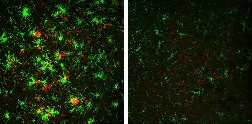 Invertito l'Alzheimer dei topi ... eliminando la proteina che fa funzionare i neuroni!?!