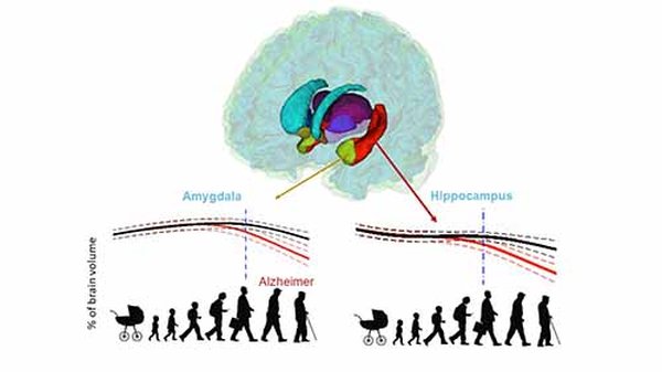 lifespan changes of human brain in azheimer