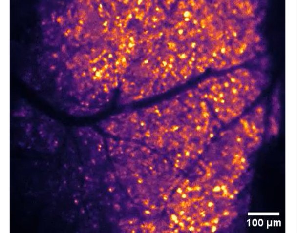 local sinks in the brain tissue oxygen levels