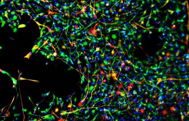 maturing neural stem cells csbp n