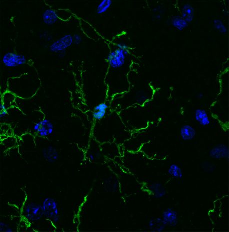 Le cellule immunitarie del cervello sono legate ad Alzheimer, Parkinson e schizofrenia