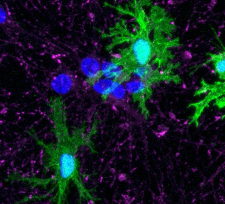 microglia from human stem cells