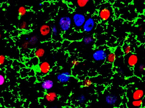 microglia geen in a sea of excitatory neurons red blue