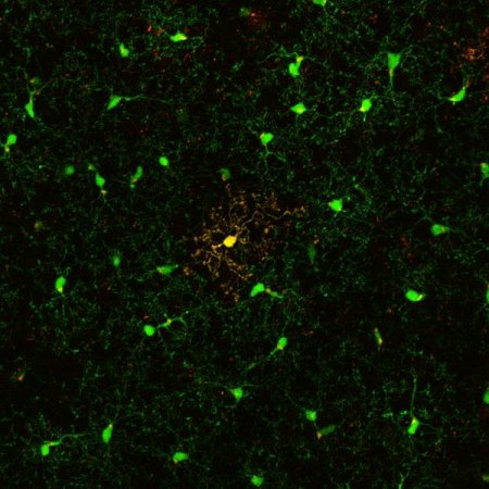 Cellule a difesa del cervello vivono più di quanto si credeva, ma ...