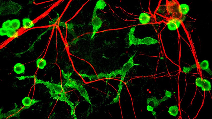 microglia-neurons-green-nerve-fiber-red.jpg