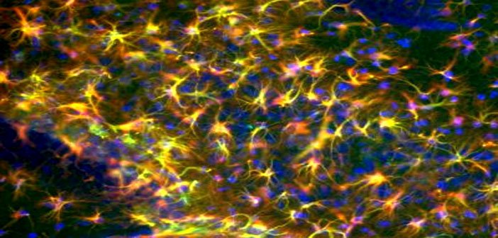 Astrociti: aumentare la memoria attraverso queste cellule che supportano i neuroni