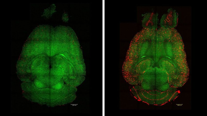 mouse brains 12h after being treated left or not right with nanoparticles JChen et al SigTransTargTher