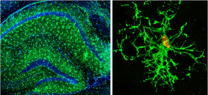 mouse hippocampus nearly completely populated by implanted human stem cell derived microglia