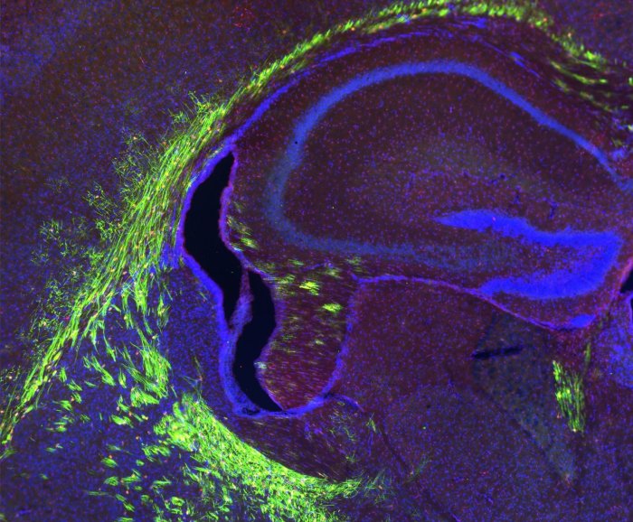 myelinated mouse brain