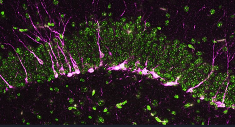 neurogenesis newborn neurons by SJ Tripathi Johns Hopkins