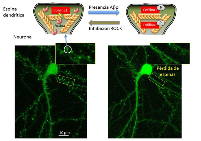 neuron cytoskeleton involved in Alzheimer
