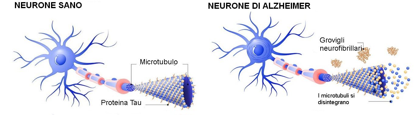 neuron tau microtubule