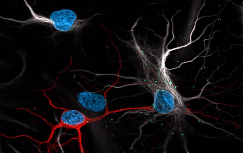 neurons off load toxic molecules to astrocytes