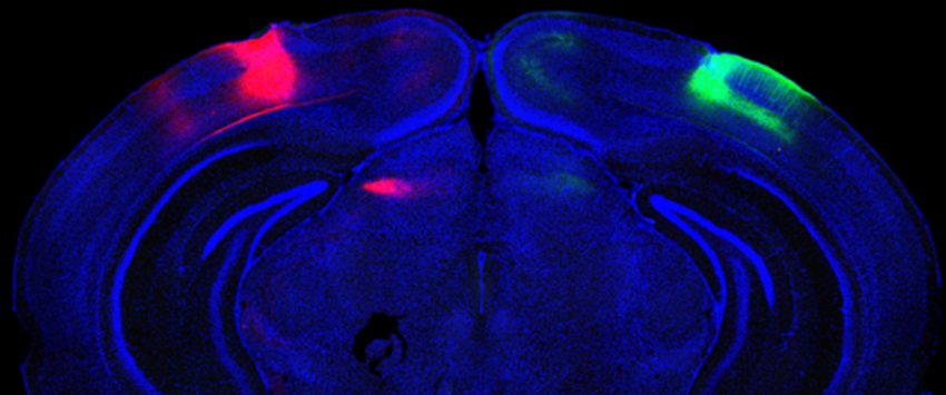 neurons connecting the visual cortices in each hemisphere