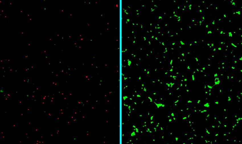 neurons dead in red and alive in green after treatment with nanotherapy 