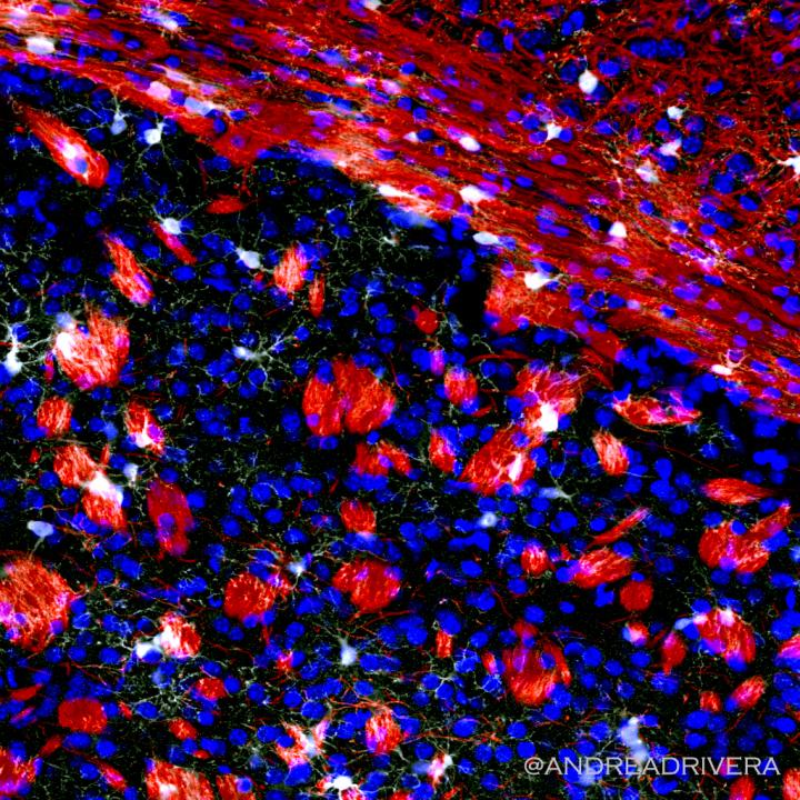 oligodendrocyte precursor cells white and myelin red