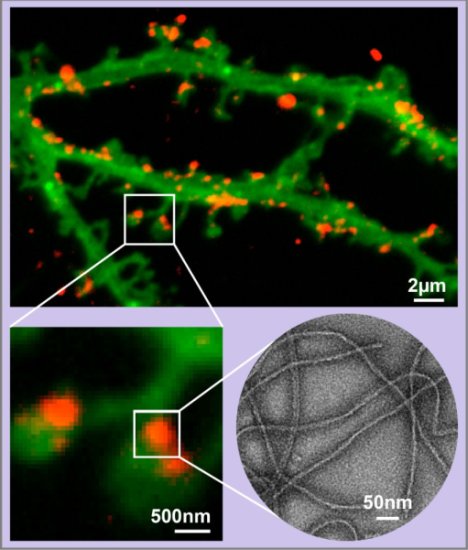 pathogenic tau aggregates attached to nerve endings