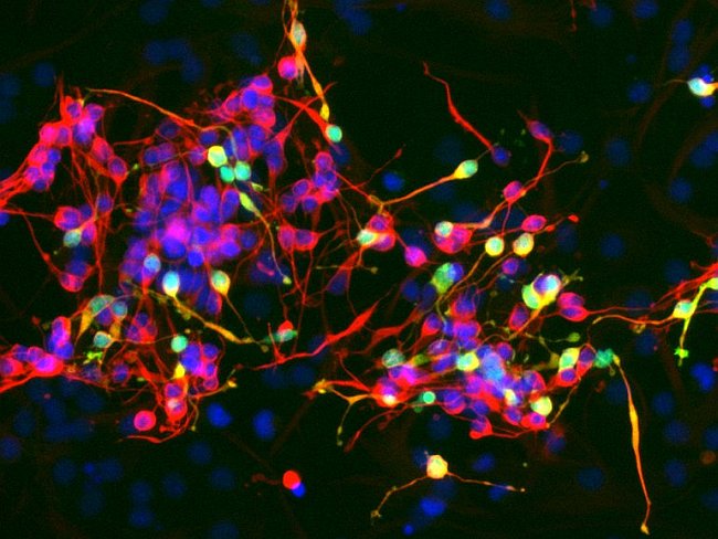 Trovato il modo di produrre neuroni da cellule staminali