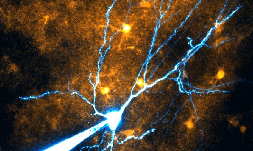 place cell with dendrites ble and astrocytes yellow