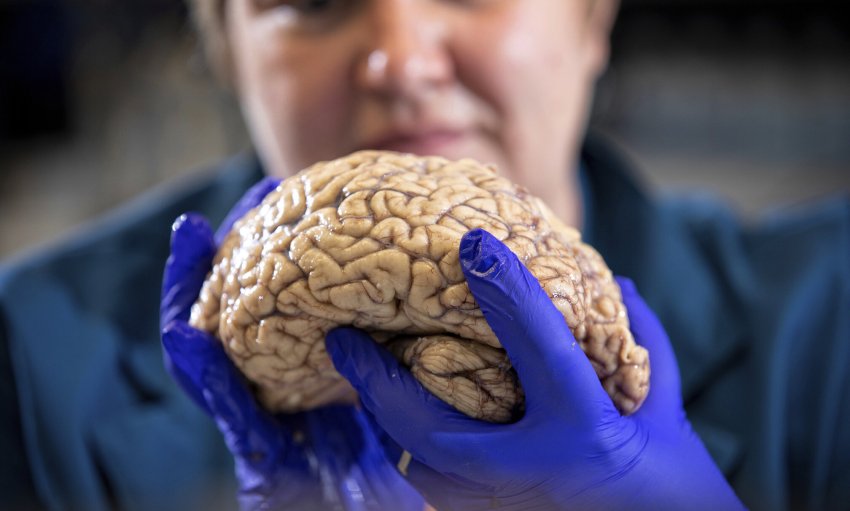 researcher holds a brain