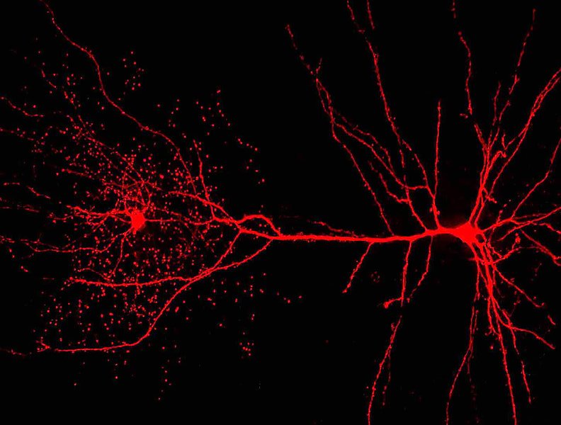 Un neurone appena scoperto può dirci cosa rende unico il cervello umano