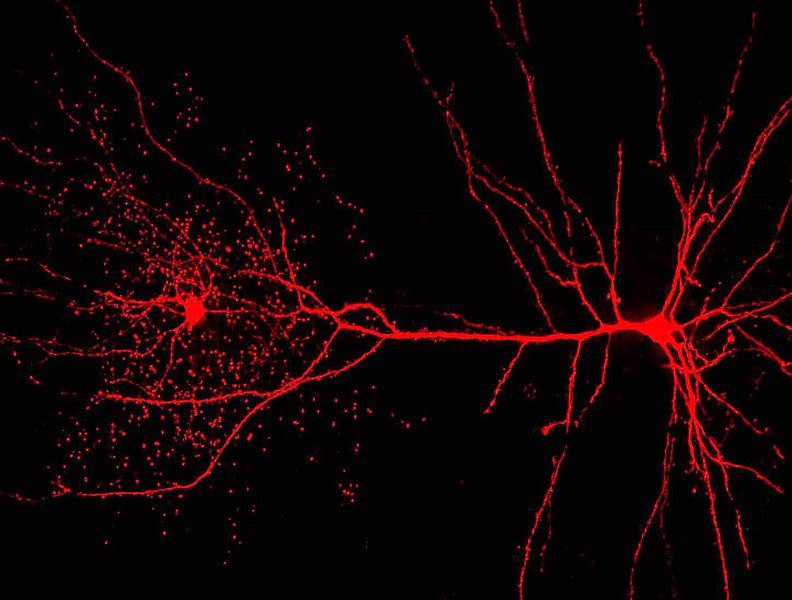 different kinds of neurons